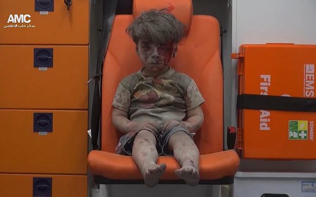 z20563263Q,5-letni-Omar-z-Aleppo